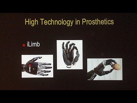 Living With Limb-Loss: Advances in Amputation Medicine