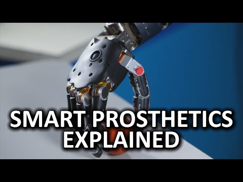 Smart Prosthetics As Fast As Possible