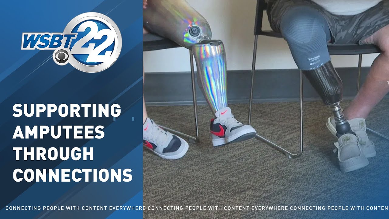 Amputee Support Group celebrates Limb Loss Awareness Month