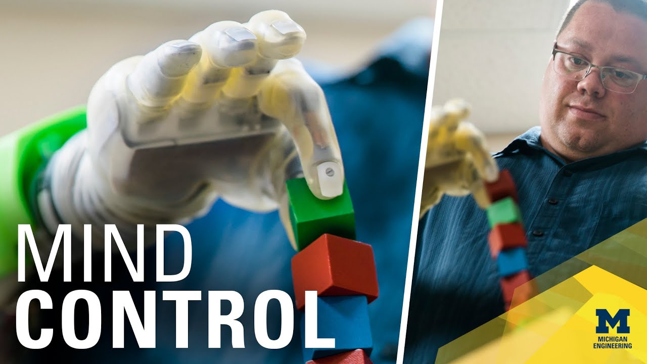 Ultra-precise, mind-controlled prosthetic hand for amputees via RPNI neural interface