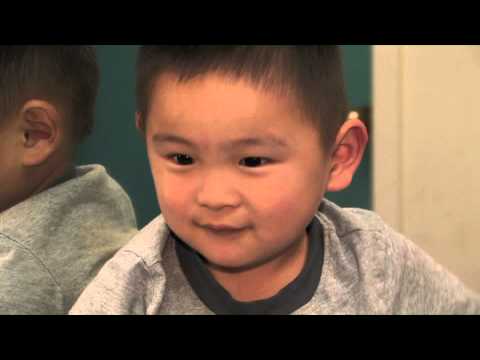 Levi's Story - First Steps with a Prosthetic Leg