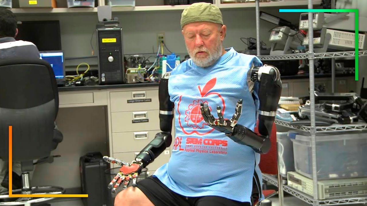 10 Prosthetics That Make Everyday Tasks Easier