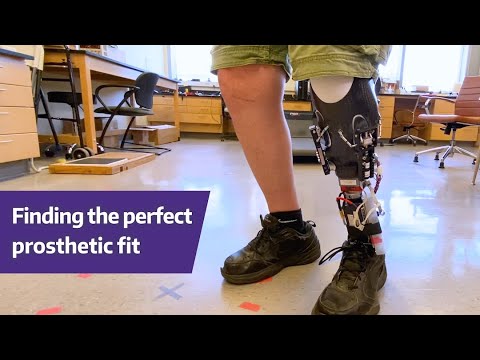 Finding the perfect prosthetic fit - Sanders UW Research Labs