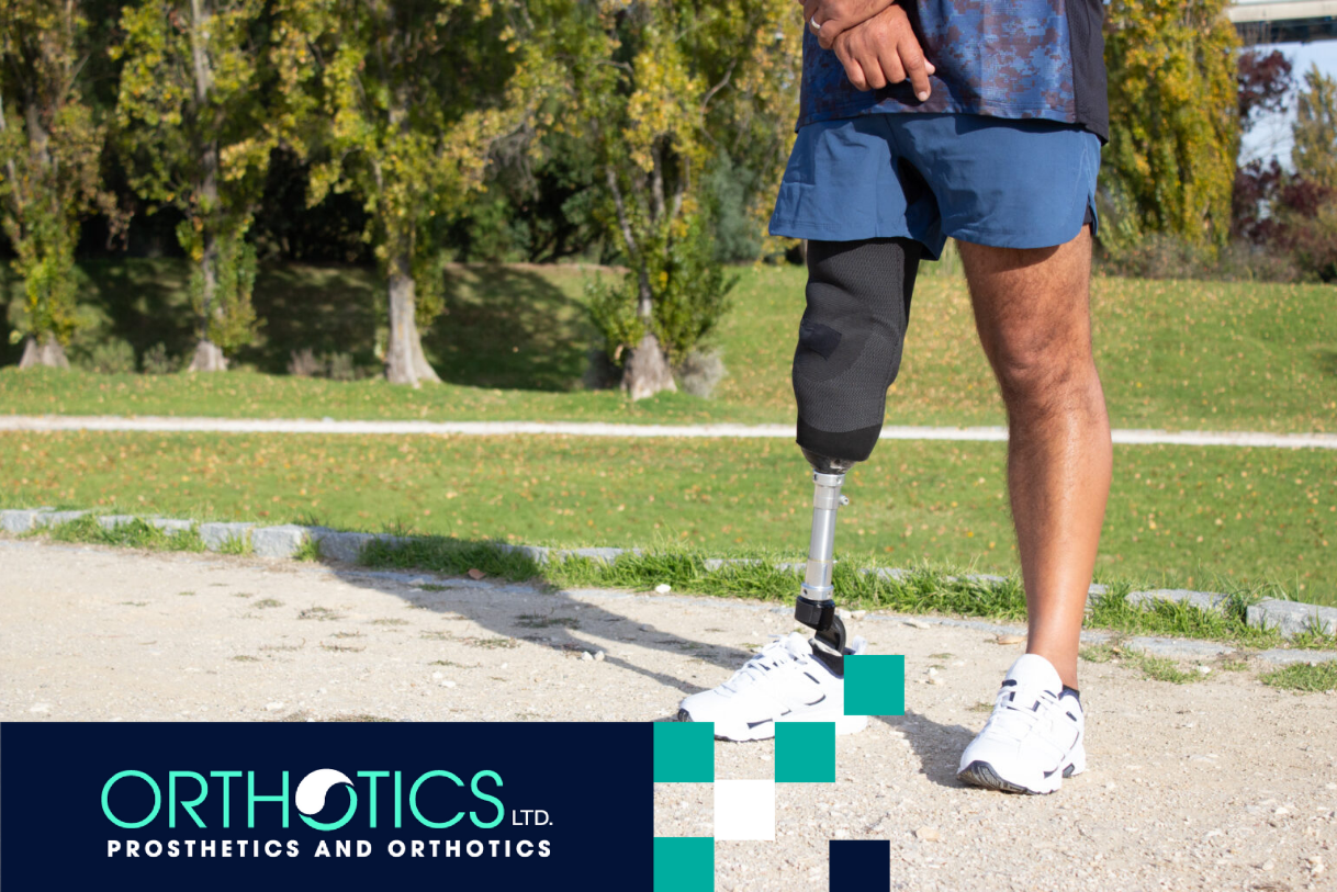 A sporty man with a prosthetic leg