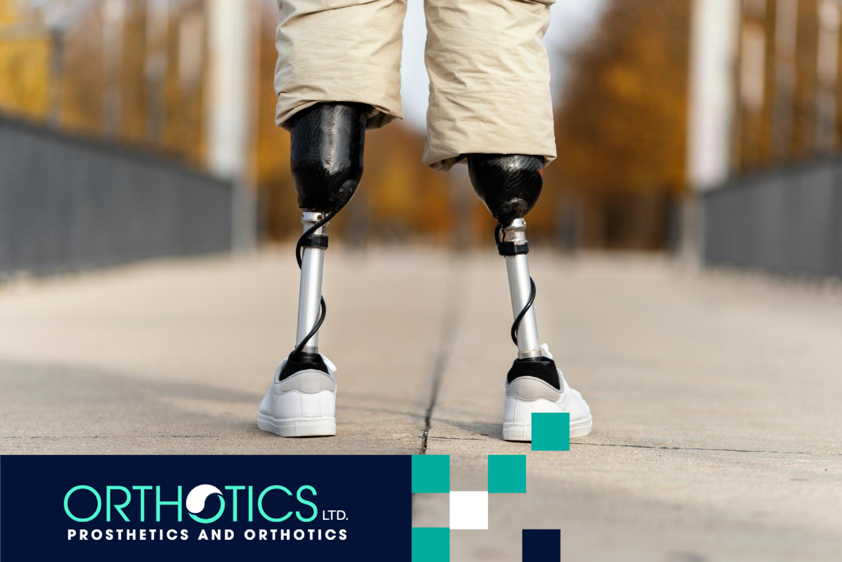 An amputee with a prosthetic legs is standing outdoors
