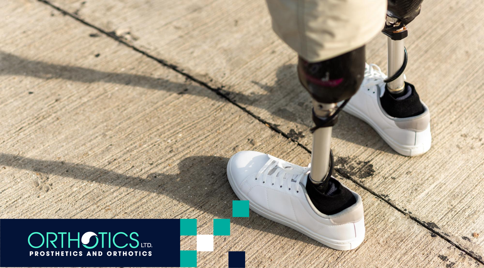 How Smart Prosthetics Are Changing Lives