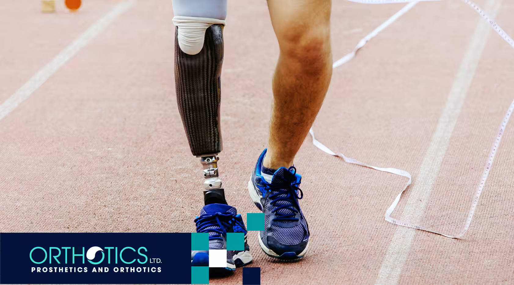 Signs It’s Time for Prosthetic Limb Replacement