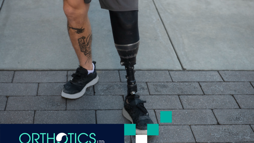 An amputee wearing a prosthetic
