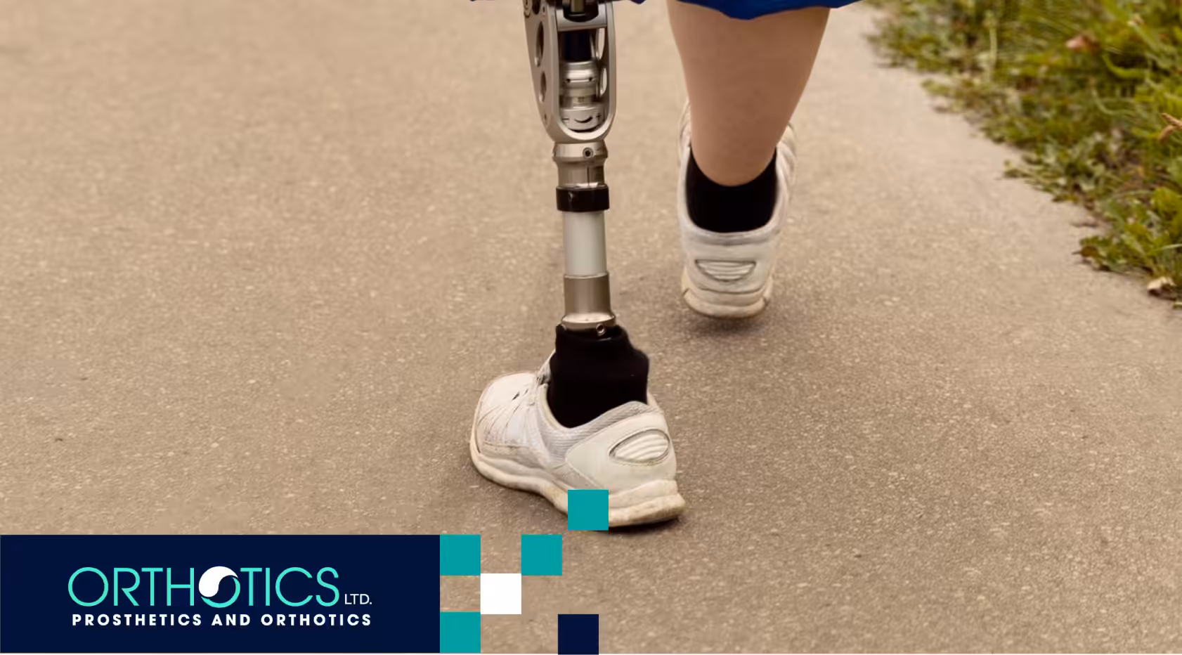 Cost of Prosthetic Limbs in 2025: Prices Explained