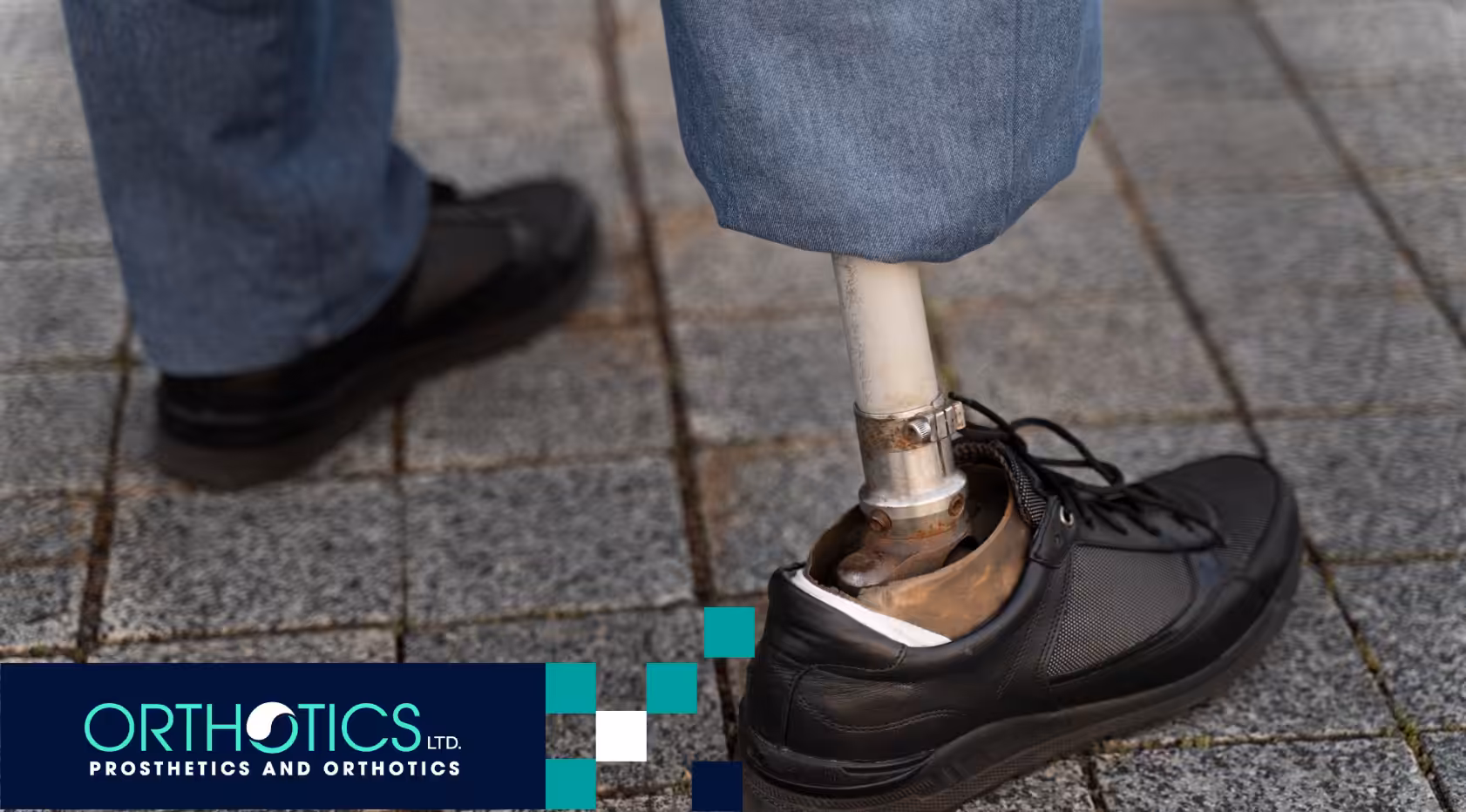 Debunking Common Myths About Prosthetic Limbs