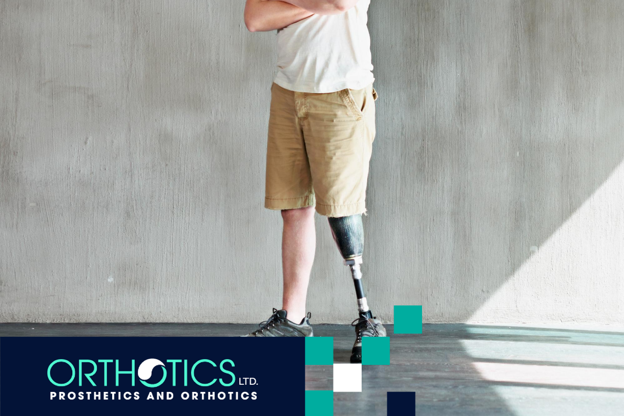 An amputee wearing prosthetics standing