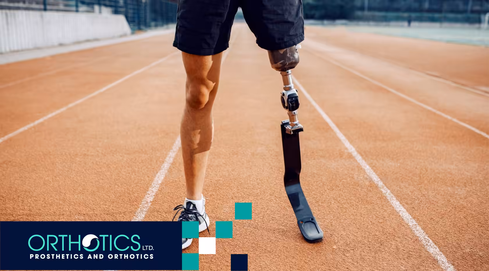 How to Prevent Injuries While Using Sports Prosthetics