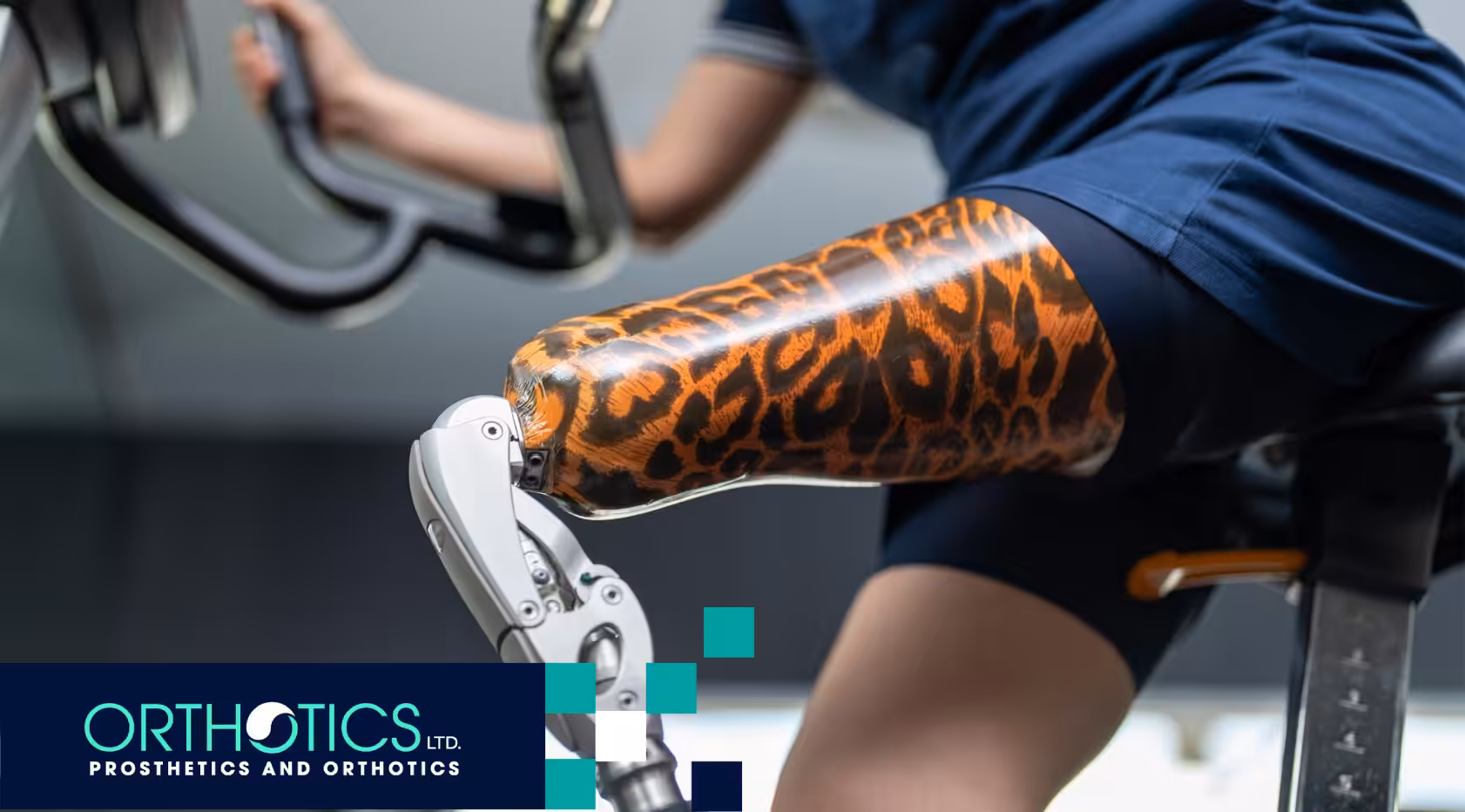 The Role of Cosmetic Covers for Prosthetics in Boosting Confidence