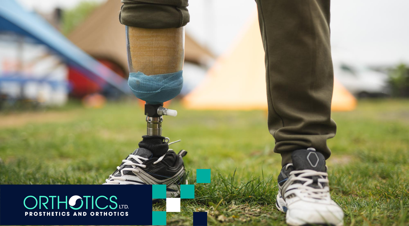 How Weight Changes Affect Prosthetic Comfort