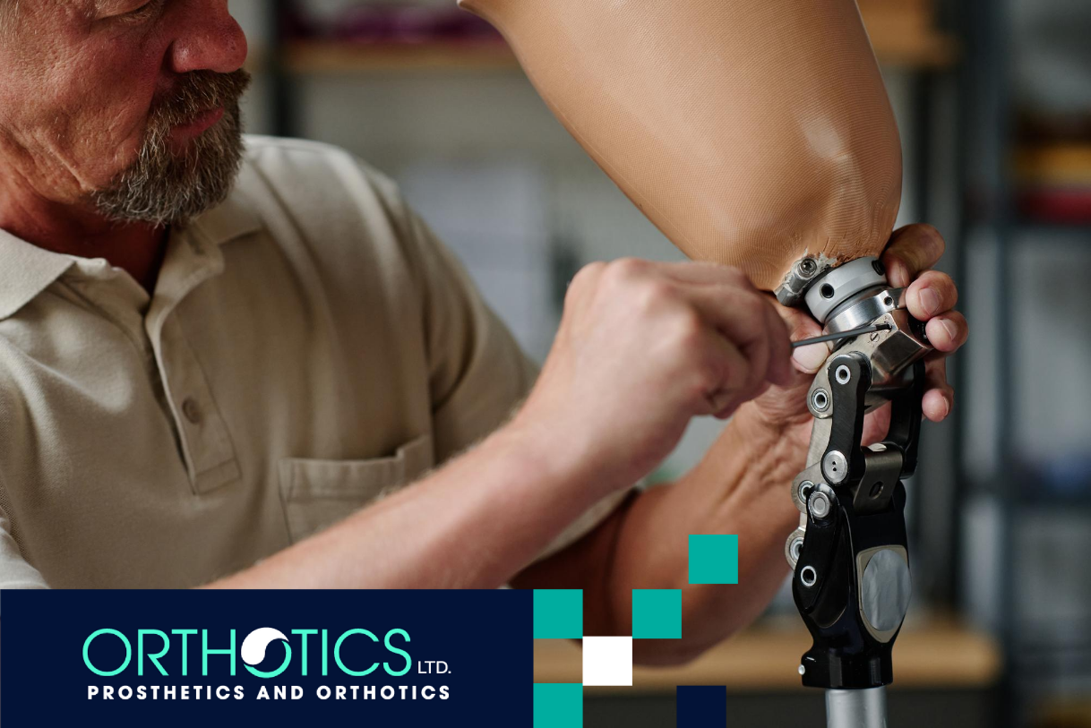 A prosthetic professional fixing a prosthetic leg