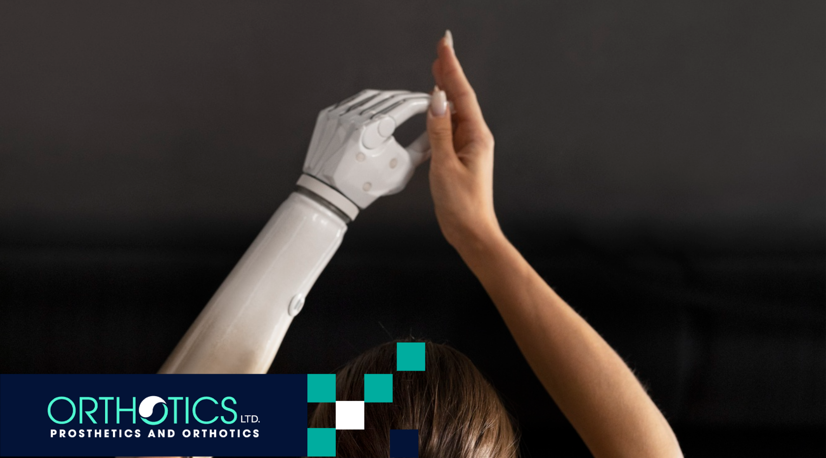 Adjusting to Life with a Myoelectric Limb