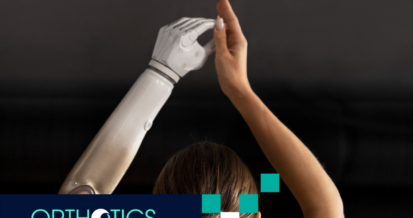 An amputee wearing a myoelectric limb doing yoga