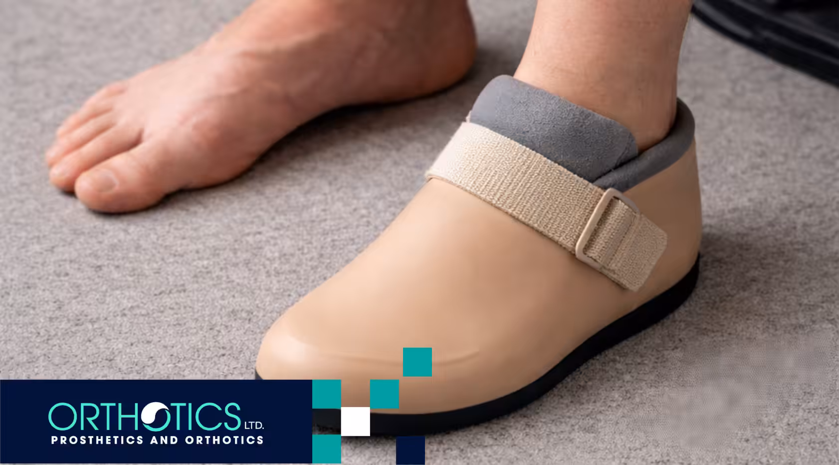 Common Challenges with Partial Foot Amputations