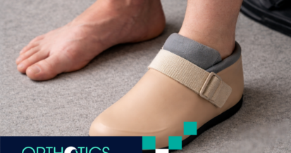 A partial foot amputee wearing a shoe