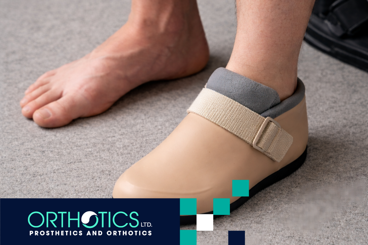 A partial foot amputee wearing a shoe