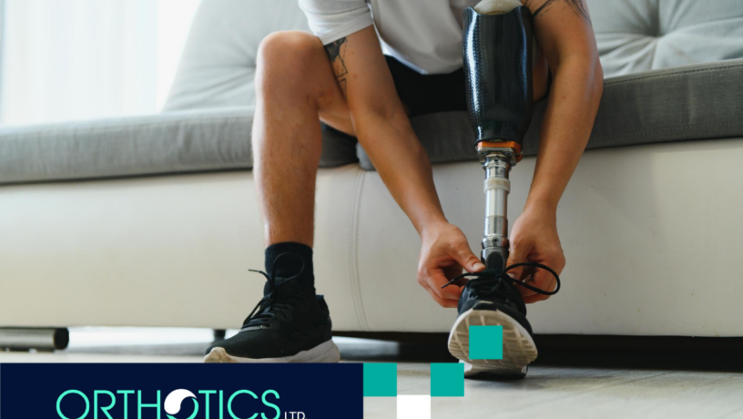 An amputee sitting on a couch wearing his prosthetic leg