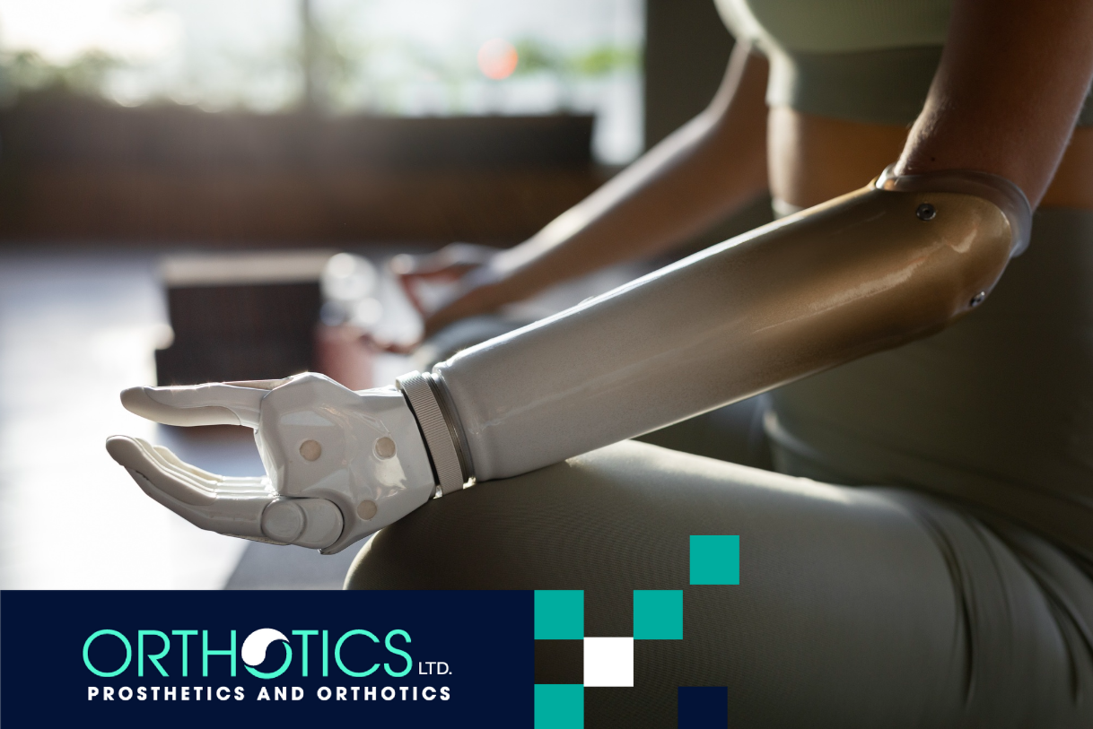 An amputee doing yoga wearing a prosthetic bionic limb