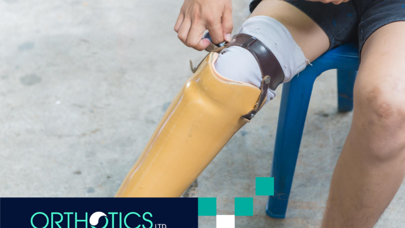 An amputee wearing a prosthesis