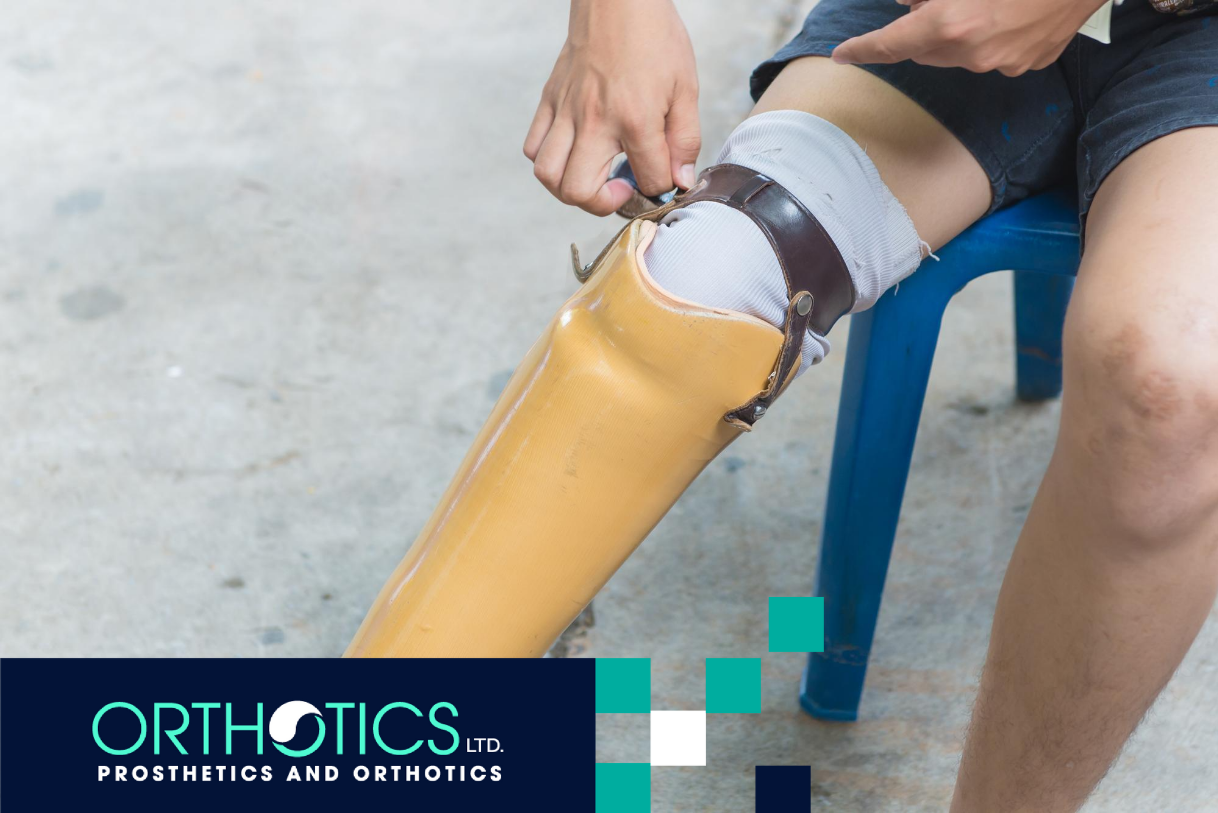 An amputee wearing a prosthesis