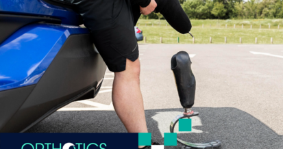 An amputee standing outdoors with his prosthetics
