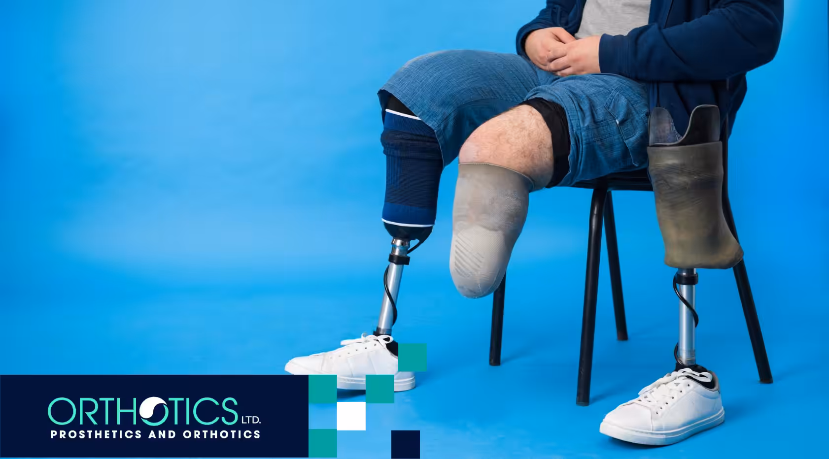 Understanding Amputation Levels for Prosthetic Choice