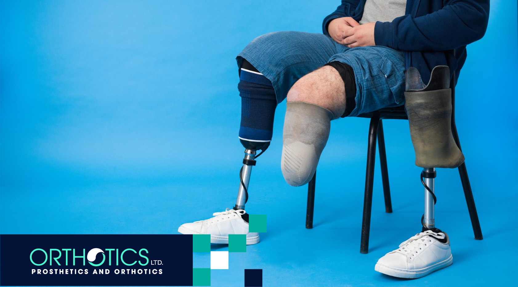 Understanding Amputation Levels for Prosthetic Choice