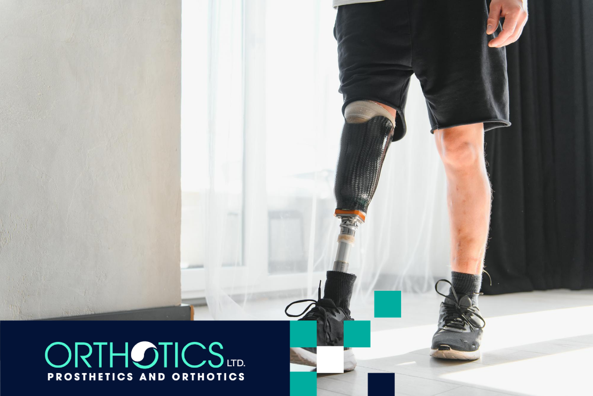 An amputee wearing prosthetic standing by a window