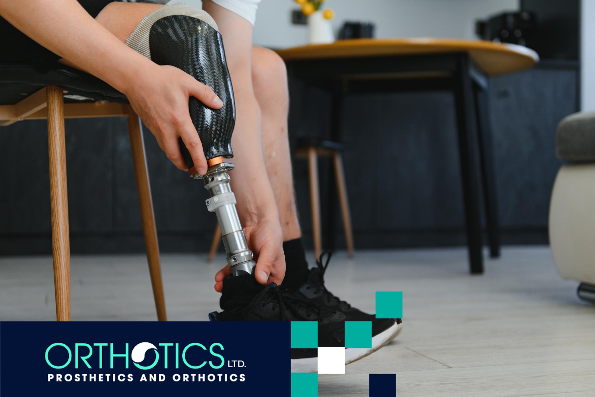 An amputee fitting his prosthetic limb