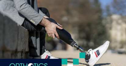 An amputee wearing prosthetic with modern socket