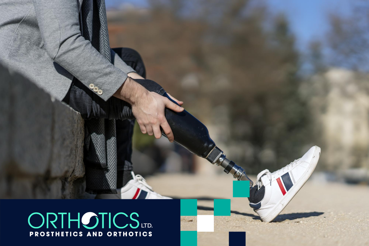 An amputee wearing prosthetic with modern socket