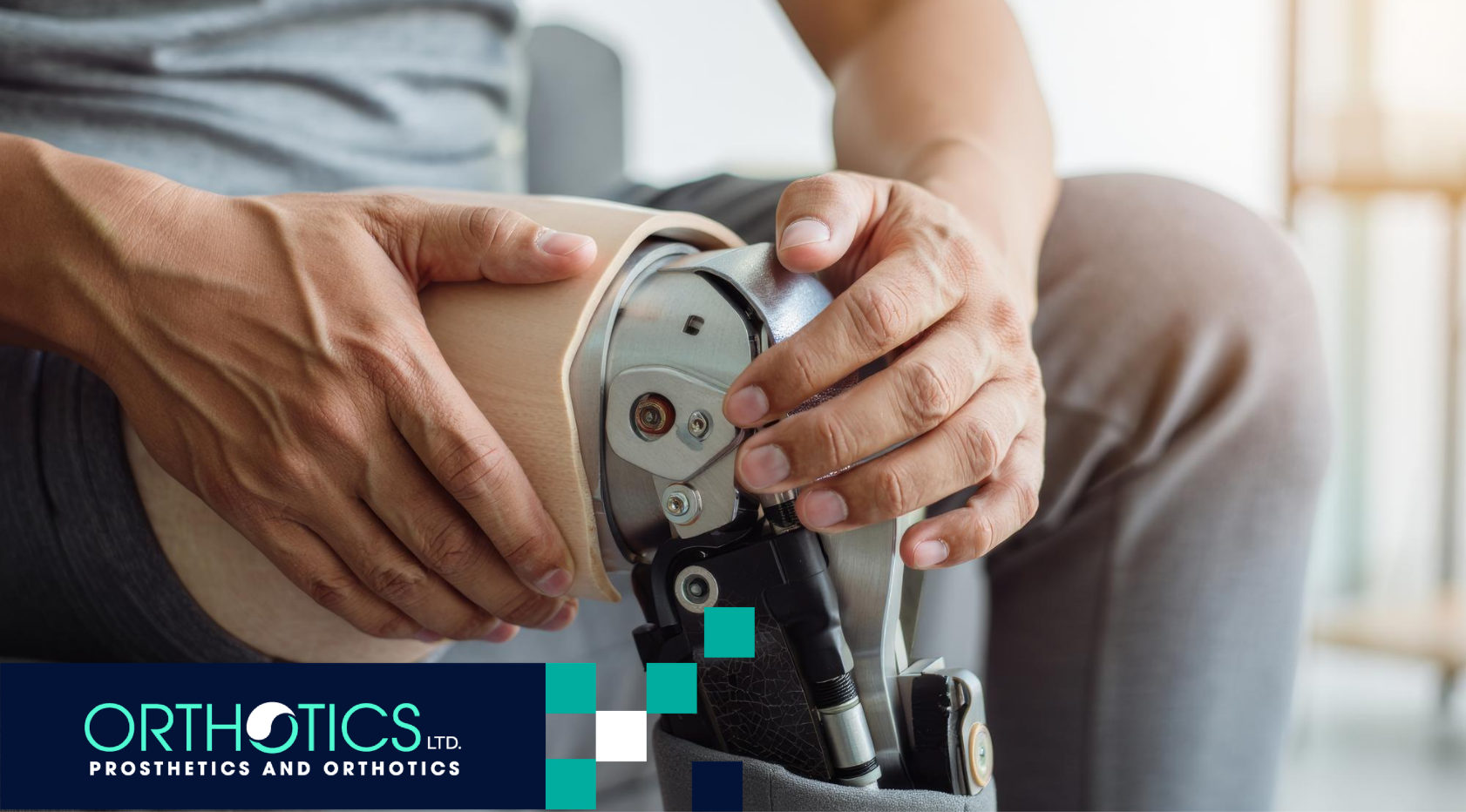 Prosthetics After Complex Wounds: What Patients Should Know