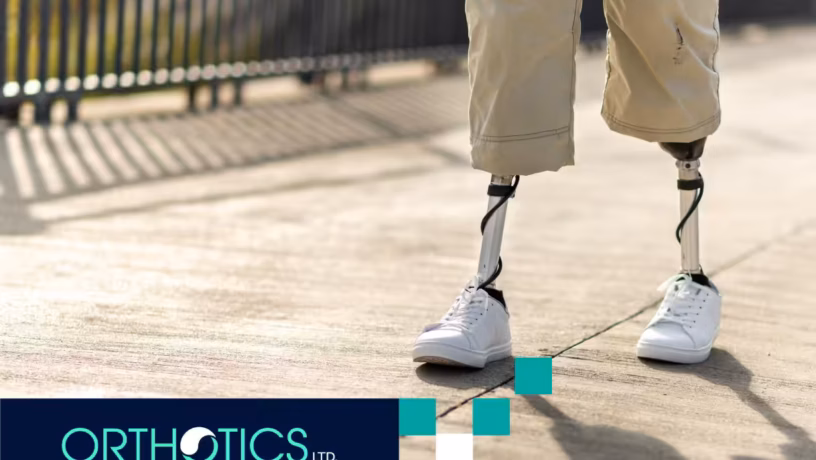 3D-Printed-Prosthetics-Featured