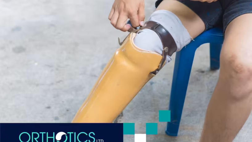Custom-Prosthetics-for-Trauma-Survivors-thumbnail