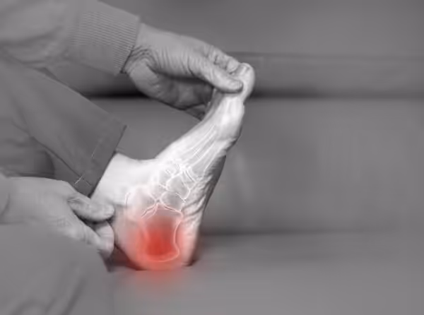 A black and white image highlighting a foot heel pain